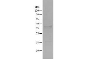 Western Blotting (WB) image for Keratin 20 (KRT20) (AA 1-139) protein (His-IF2DI Tag) (ABIN7123675) (KRT20 Protein (AA 1-139) (His-IF2DI Tag))
