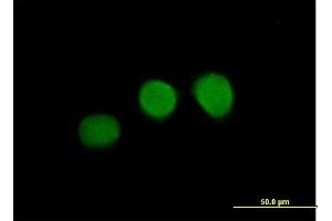 Immunofluorescence of purified MaxPab antibody to WDR45 on HeLa cell. (WDR45 antibody  (AA 1-360))