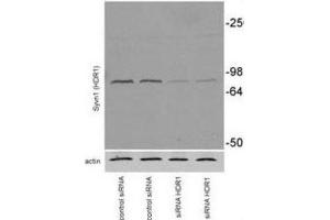 Western Blotting (WB) image for anti-Synovial Apoptosis Inhibitor 1, Synoviolin (SYVN1) antibody (ABIN2995229)