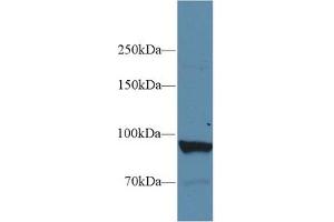 Western Blot; Sample: Human Liver lysate; Primary Ab: 1µg/ml Rabbit Anti-Human PYGL Antibody Second Ab: 0. (PYGL antibody  (AA 633-820))