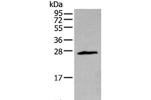 Western blot analysis of Jurkat cell using ZNF22 Polyclonal Antibody at dilution of 1:400 (Zinc Finger Protein 22 antibody)