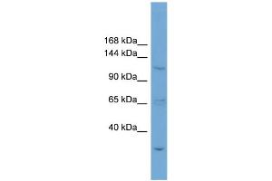 WB Suggested Anti-ZNF624 Antibody Titration: 0. (ZNF624 antibody  (N-Term))
