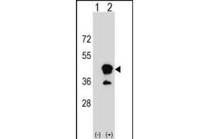 Western blot analysis of CD1B (arrow) using rabbit polyclonal CD1B Antibody (N-term) (ABIN1539475 and ABIN2849952). (CD1b antibody  (N-Term))