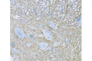 Immunohistochemistry of paraffin-embedded Mouse spinal cord using ATP1B2 Polyclonal Antibody at dilution of 1:100 (40x lens). (ATP1B2 antibody)