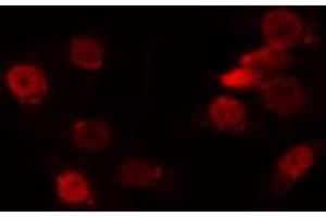 ABIN6272354 staining HuvEc by IF/ICC. (NANOGP8 antibody)