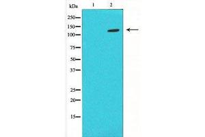 Western blot analysis of extracts from K562 cells, using PLCB2 antibody. (Phospholipase C beta 2 antibody  (Internal Region))