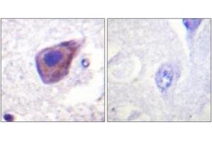 Immunohistochemistry analysis of paraffin-embedded human brain tissue, using Gz-alpha (Ab-16) Antibody. (GNaZ antibody  (AA 1-50))