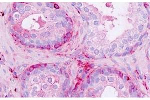 Human Prostate: Formalin-Fixed, Paraffin-Embedded (FFPE) (NPDC1 antibody  (AA 189-238))