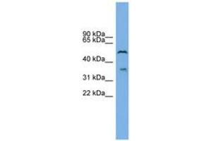 Image no. 1 for anti-beta-1,3-Glucuronyltransferase 3 (Glucuronosyltransferase I) (B3GAT3) (AA 35-84) antibody (ABIN6744830) (B3GAT3 antibody  (AA 35-84))