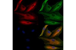 ABIN6259863 and ABIN6279104 staining  cells by IF/ICC. (AKR1C4 antibody  (N-Term))