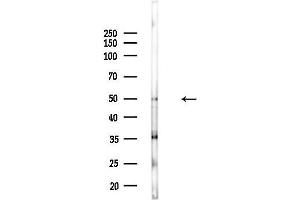 anti-Protein Phosphatase, Mg2+/Mn2+ Dependent, 1B (PPM1B) (C-Term) antibody