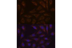 Immunofluorescence analysis of U-2 OS cells using DCP1A Rabbit mAb (ABIN7266678) at dilution of 1:100 (40x lens). (DCP1A antibody)