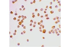 Immunohistochemistry (IHC) image for anti-Caspase 9, Apoptosis-Related Cysteine Peptidase (CASP9) (Middle Region 2) antibody (ABIN1031198)