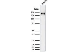 Western Blot Analysis of human brain tissue lysate using Neurofilament Mouse Recombinant Monoclonal Antibody (rNF421). (Recombinant NEFH antibody)