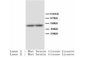 Image no. 1 for anti-Tryptophan Hydroxylase 1 (TPH1) antibody (Magnetic Particles) (ABIN1502617) (Tryptophan Hydroxylase 1 antibody  (Magnetic Particles))