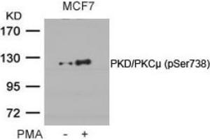 Image no. 2 for anti-Protein Kinase D1 (PRKD1) (pSer738) antibody (ABIN196754) (PKC mu antibody  (pSer738))