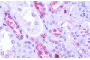 Human Kidney: Formalin-Fixed, Paraffin-Embedded (FFPE) (GPR50 antibody  (C-Term))