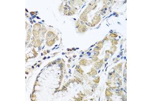 Immunohistochemistry of paraffin-embedded human stomach using IFNL3 antibody (ABIN6293714) at dilution of 1:100 (40x lens). (IL28B antibody)