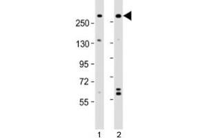 Western blot testing of human 1) A431 and 2) U-2OS cell lysate with NBAS antibody at 1:2000.