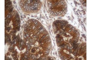 Image no. 1 for anti-IlvB (Bacterial Acetolactate Synthase)-Like (ILVBL) antibody (ABIN1498882) (ILVBL antibody)