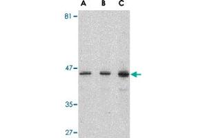 Western blot analysis of PSEN1 in human brain lysate with PSEN1 polyclonal antibody  at (A) 0. (Presenilin 1 antibody  (C-Term))