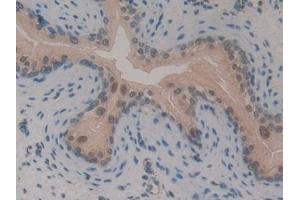 Detection of GLI3 in Mouse Vas Deferens Tissue using Polyclonal Antibody to GLI Family Zinc Finger Protein 3 (GLI3) (GLI Family Zinc Finger Protein 3 (AA 303-561) antibody)