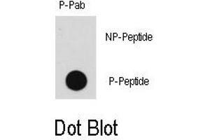 Image no. 1 for anti-Mitogen-Activated Protein Kinase Kinase Kinase 8 (MAP3K8) (pThr290) antibody (ABIN358351) (MAP3K8 antibody  (pThr290))