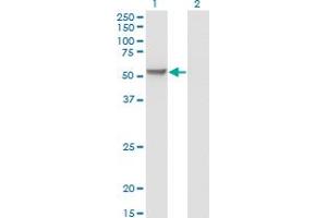 Western Blot analysis of MPP1 expression in transfected 293T cell line by MPP1 monoclonal antibody (M01), clone 1E11-1G11. (MPP1 antibody  (AA 1-466))