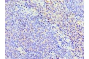 Immunohistochemistry of paraffin-embedded human tonsil tissue using ABIN7173805 at dilution of 1:100 (BAFF antibody  (AA 76-285))