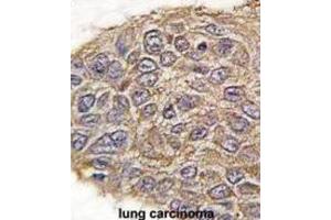 Immunohistochemistry (IHC) image for anti-Aldolase (ALD) antibody (ABIN3001589) (Aldolase antibody)