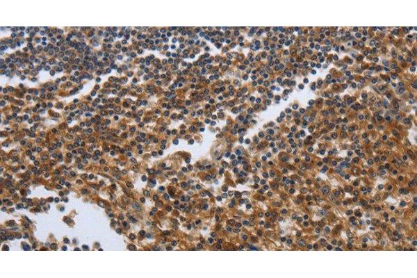 PDCD2 antibody