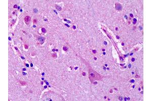 Anti-GRM7 / MGLUR7 antibody IHC of human brain, cortex, neurons. (GRM7 antibody  (Extracellular Domain))