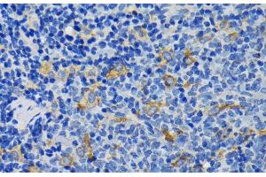 Immunohistochemistry of paraffin-embedded Rat spleen using IQGAP1 Polyclonal Antibody at dilution of 1:200 (40x lens). (IQGAP1 antibody)
