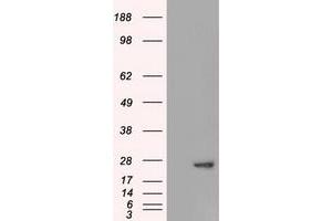 HEK293T cells were transfected with the pCMV6-ENTRY control (Left lane) or pCMV6-ENTRY AK1 (Right lane) cDNA for 48 hrs and lysed. (Adenylate Kinase 1 antibody)