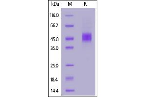 SDS-PAGE (SDS) image for Interleukin 2 Receptor, beta (IL2RB) (AA 27-240) protein (His tag) (ABIN6992390)