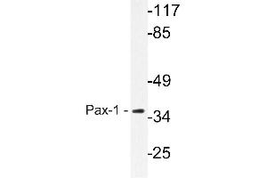 Western blot (WB) analysis of Pax-1 antibody in extracts from HeLa cells. (PAX1 antibody)