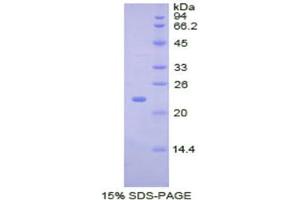 SDS-PAGE (SDS) image for Bone Morphogenetic Protein 4 (BMP4) (AA 227-408) protein (His tag) (ABIN1877365)