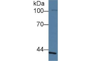 Western Blot; Sample: Human Lung lysate; ;Primary Ab: 1µg/ml Rabbit Anti-Human SLFN5 Antibody;Second Ab: 0. (SLFN5 antibody  (AA 658-891))