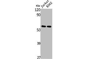 Western Blot analysis of Jurkat K562 cells using SS-56 Polyclonal Antibody (TRIM68 antibody  (Internal Region))
