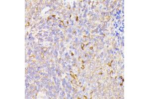 Immunohistochemistry of paraffin-embedded rat spleen using PSMG1 antibody (ABIN7269593) at dilution of 1:100 (40x lens). (PSMG1 antibody  (AA 1-288))