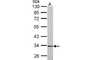 Western Blotting (WB) image for anti-Hydroxyacyl-CoA Dehydrogenase (HADH) antibody (ABIN2856051)