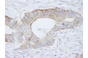 anti-Spectrin Beta, Non-Erythrocytic 1 (SPTBN1) (AA 2150-2200) antibody