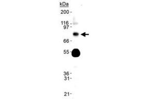 Western blot analysis of Phospho-Slc9a3 in human kidney lysate using with Slc9a3 (phospho S552) monoclonal antibody, clone 14D5 . (SLC9A3 antibody  (pSer552))