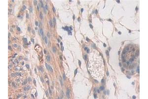 DAB staining on IHC-P; Samples: Mouse Uterus Tissue (STAT2 antibody  (AA 658-912))