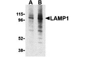 Western Blotting (WB) image for anti-Lysosomal-Associated Membrane Protein 1 (LAMP1) (Middle Region) antibody (ABIN1030977) (LAMP1 antibody  (Middle Region))