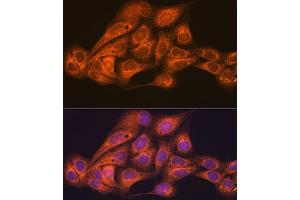 Immunofluorescence analysis of U-2 OS cells using CLOCK Rabbit mAb (ABIN7266414) at dilution of 1:100 (40x lens). (CLOCK antibody)
