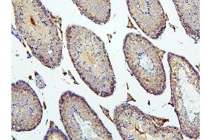 IHC analysis of BUB1B using anti-BUB1B antibody (ABIN7600962).