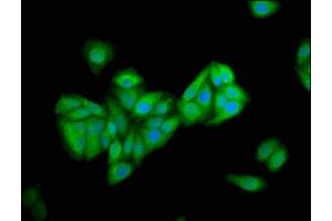 Immunofluorescence (IF) image for anti-Patatin-Like phospholipase Domain Containing 5 (PNPLA5) (AA 90-205) antibody (ABIN7162698)
