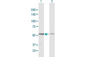 Western Blot analysis of GTF2E1 expression in transfected 293T cell line by GTF2E1 MaxPab polyclonal antibody. (GTF2E1 antibody  (AA 1-439))