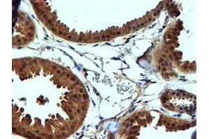 Immunohistochemical staining of paraffin-embedded Human breast tissue using anti-C2orf56 mouse monoclonal antibody. (NDUFAF7 antibody)